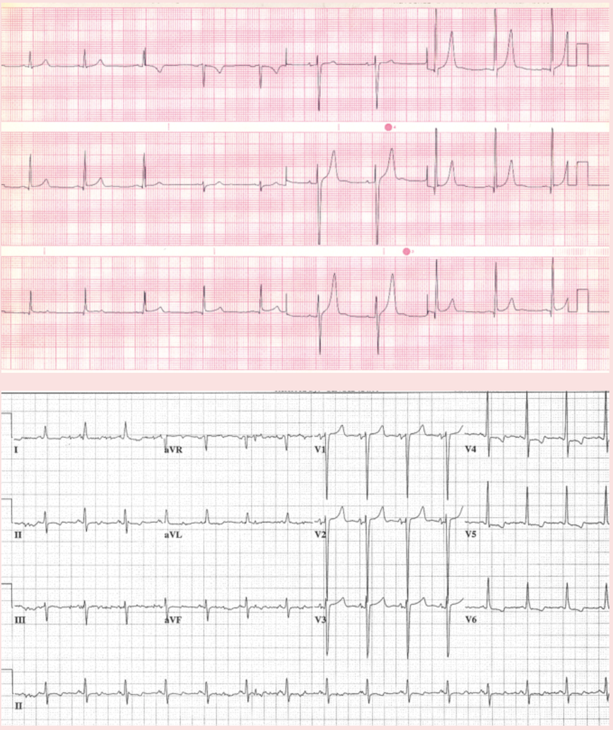 CardioNerds ECG Challenge #9 - Cardionerds