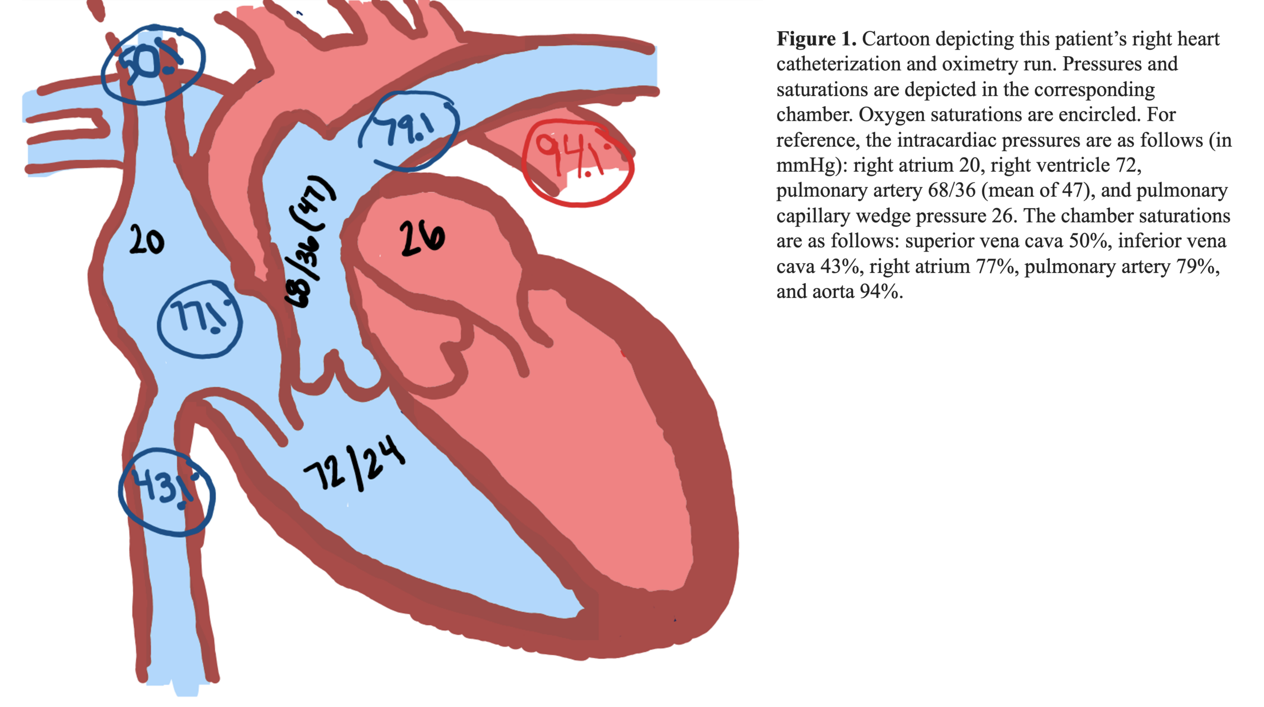 Venous Sinuses